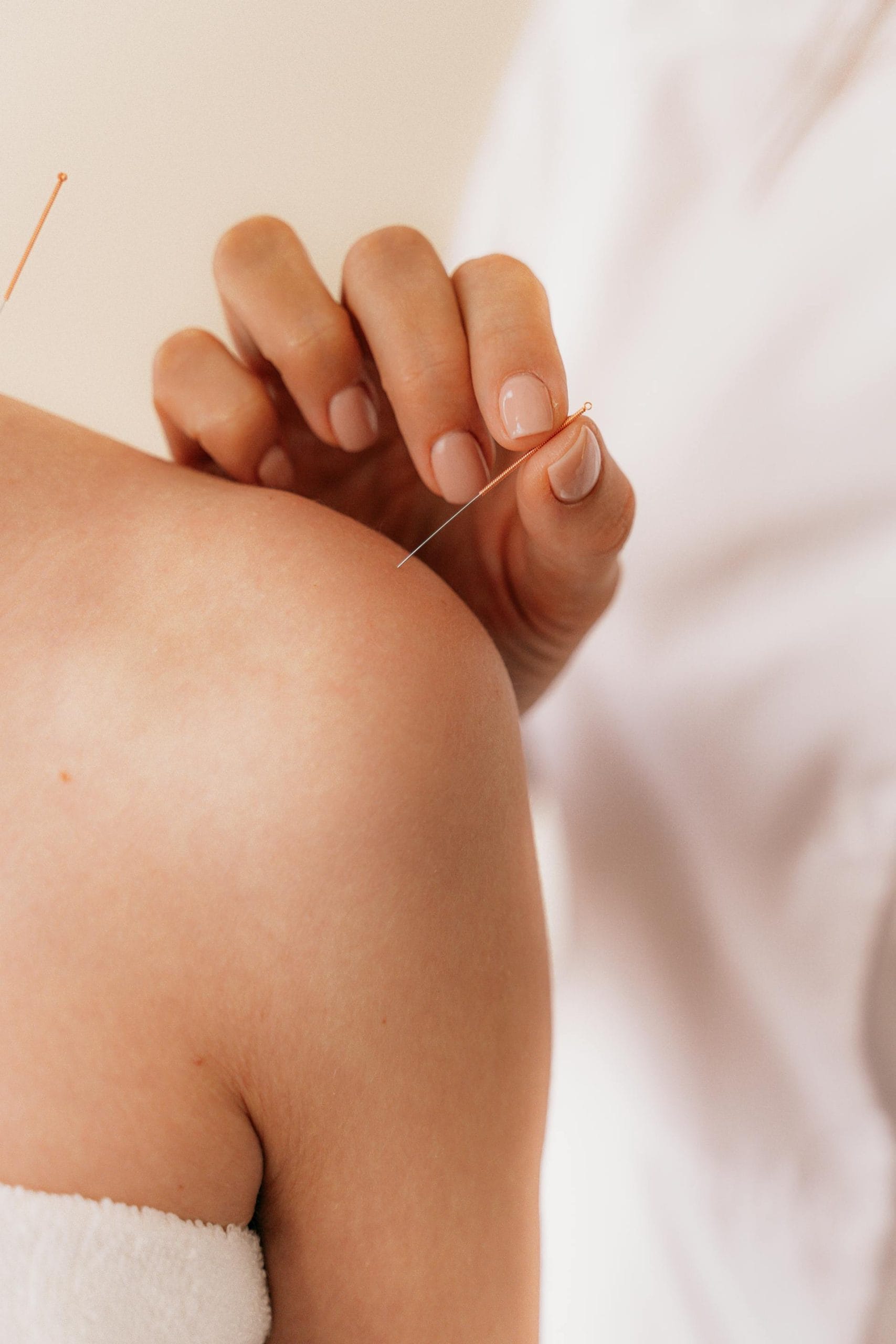Shoulder Pain Clinic Logan City | Myotherapy & Dry Needling
